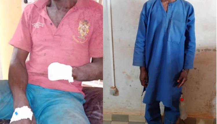 Bénin un bouvier coupe le poingnet gauche d'un cultivateur à Kalalé