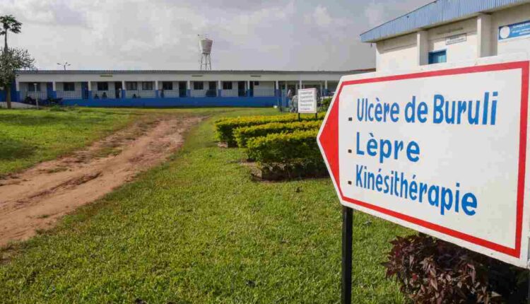 Front du CDTLUB de Pobè contre les MTN: le Bénin passe de 300 cas de lèpre par an à 85 cas en 2025
