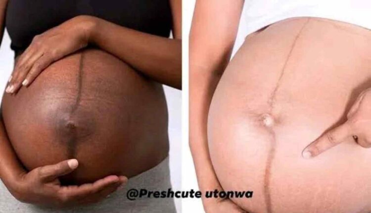 La linea nigra trait noir sur le ventre d'une femme enceinte